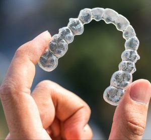 Rovnátka - srovnání typů. Detail neviditelných rovnátek Invisalign